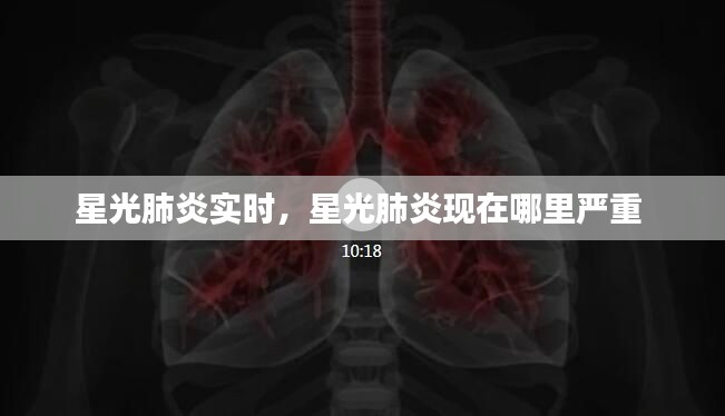 星光肺炎實(shí)時(shí)，星光肺炎現(xiàn)在哪里嚴(yán)重 
