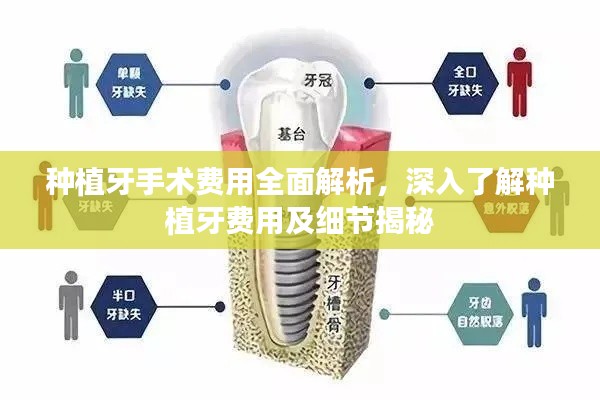 種植牙手術費用全面解析，深入了解種植牙費用及細節(jié)揭秘