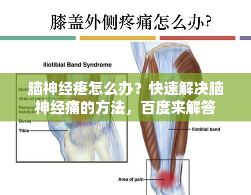 腦神經(jīng)疼怎么辦？快速解決腦神經(jīng)痛的方法，百度來解答
